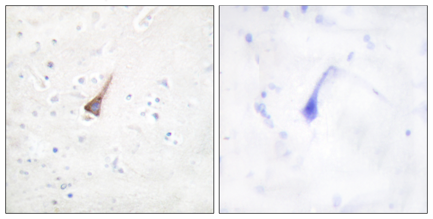 Anti-PTP1B Antibody Anti-PTP1B Antibody