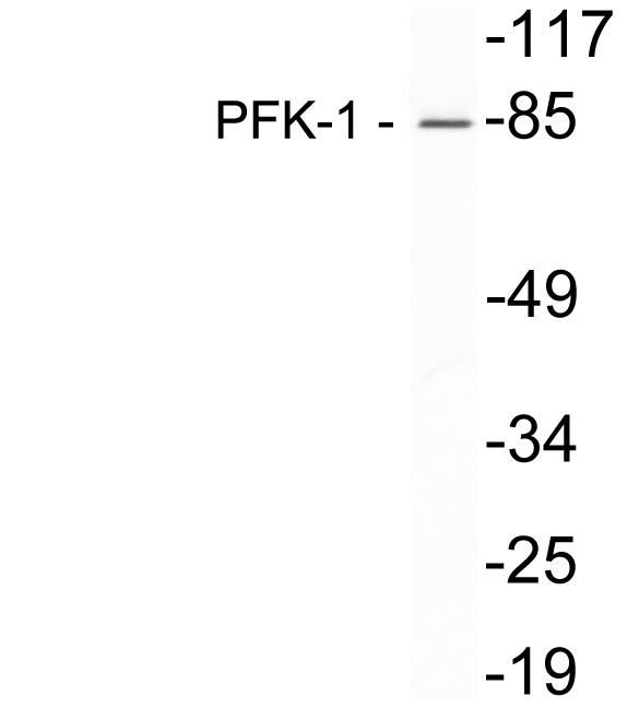 Anti-PFK-1 Antibody