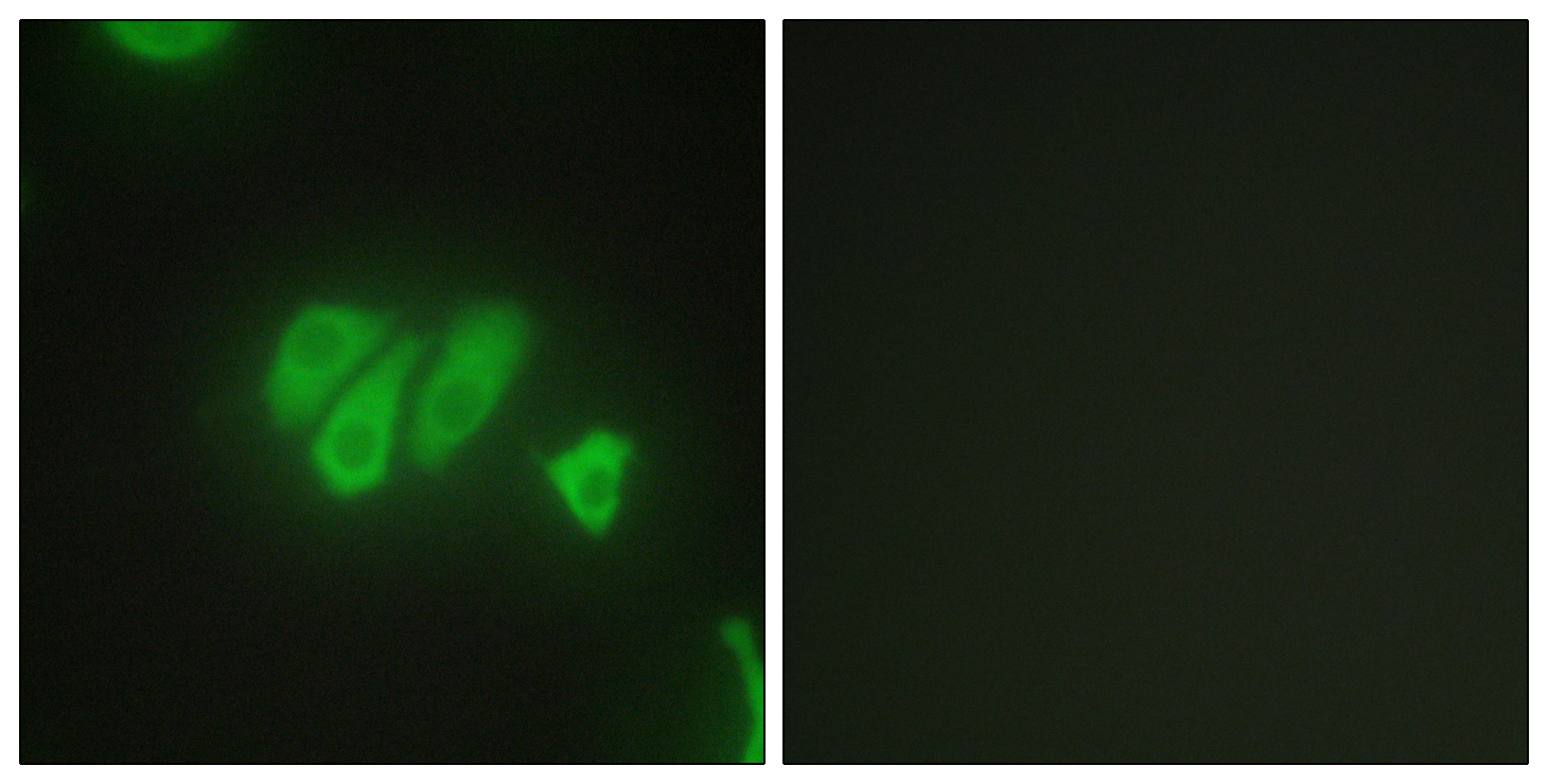 Anti-PDZD2 Antibody - Identical to Abcam (ab196631)