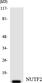 Anti-NUTF2 Antibody