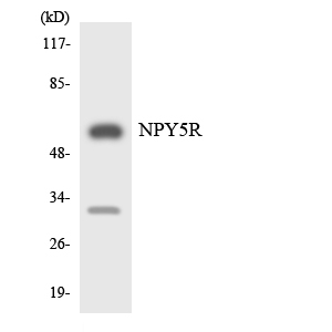 Anti-NPY5R Antibody