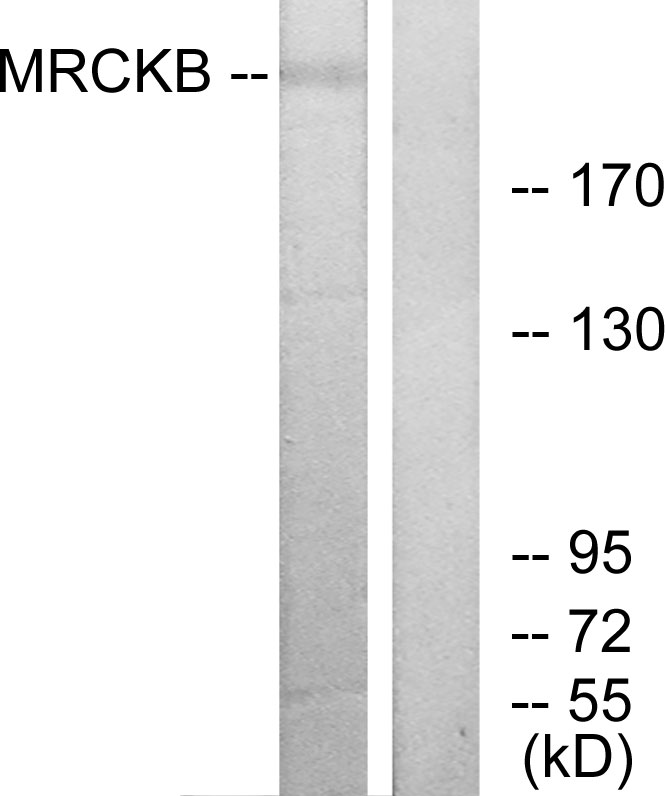 Anti-MRCKB Antibody