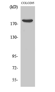 Anti-MRCKB Antibody Anti-MRCKB Antibody