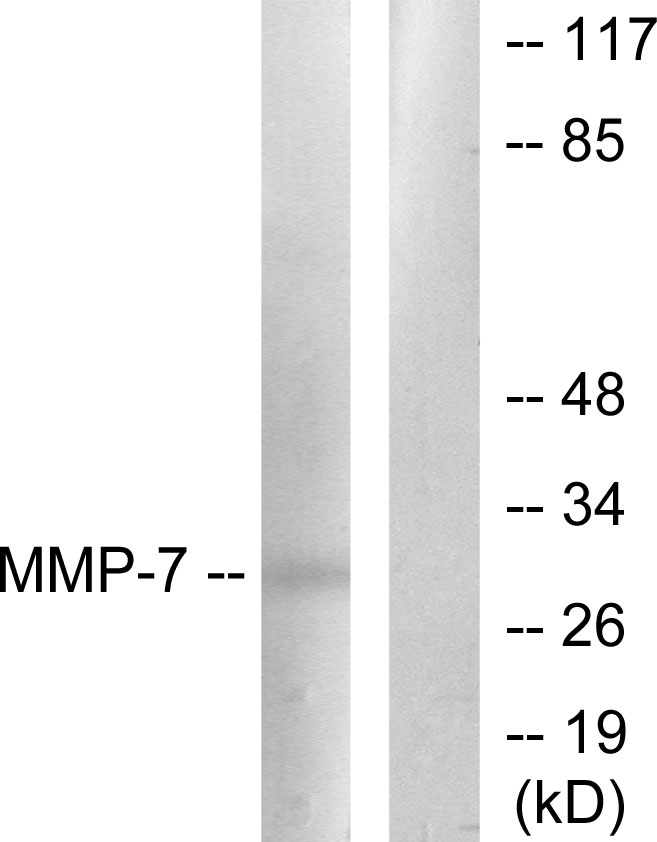 Anti-MMP-7 Antibody - Identical to Abcam (ab189277)