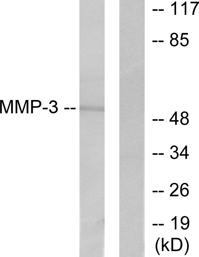 Anti-MMP-3 Antibody - Identical to Abcam (ab53015)