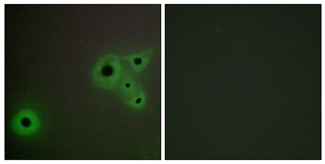 Anti-MED23 Antibody - Identical to Abcam (ab196752) Anti-MED23 Antibody - Identical to Abcam (ab196752)