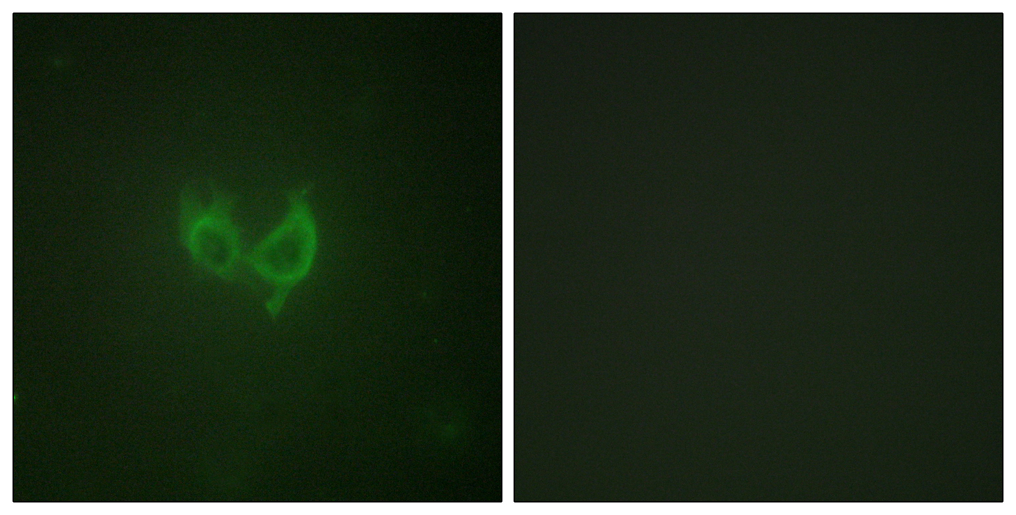 Anti-MARK2 Antibody - Identical to Abcam (ab133178)