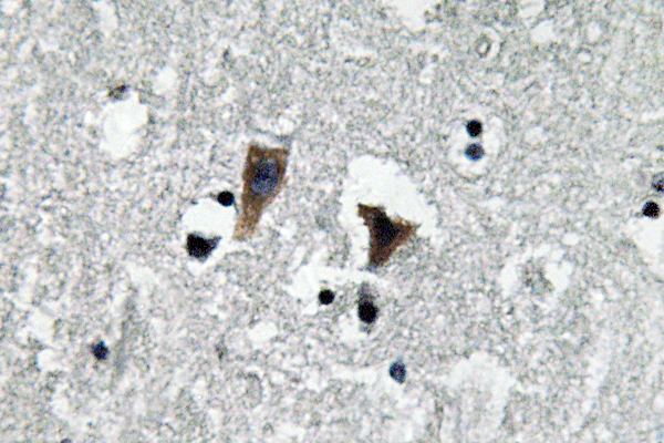 Anti-MAO-A Antibody Anti-MAO-A Antibody