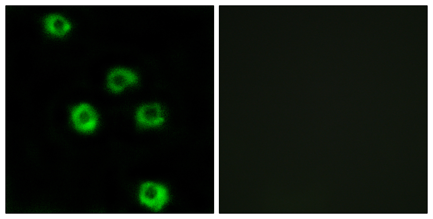 Anti-LPHN2 Antibody - Identical to Abcam (ab139498)