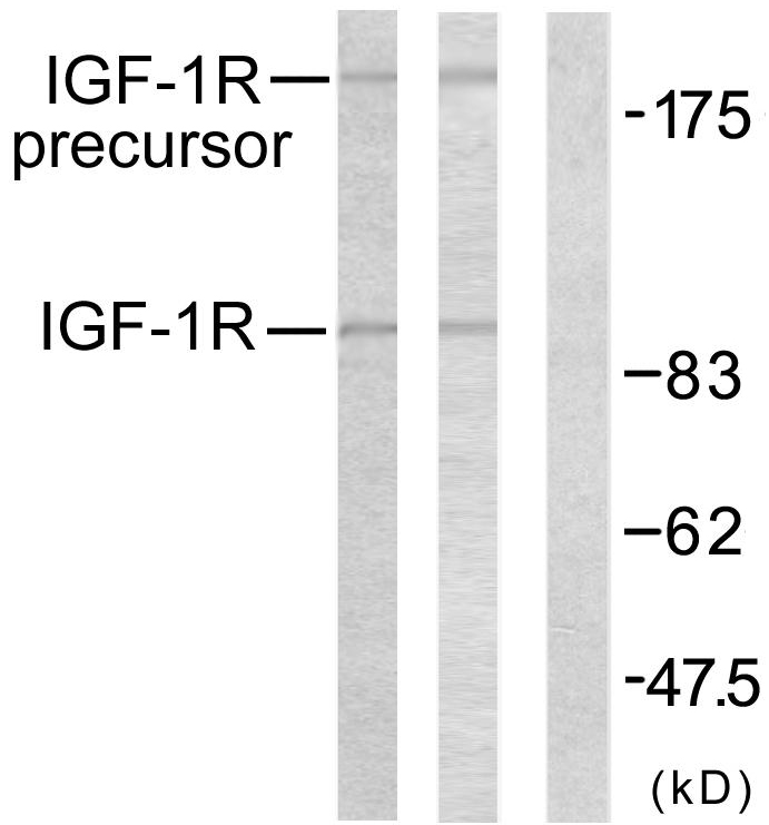 Anti-IGF1R Antibody
