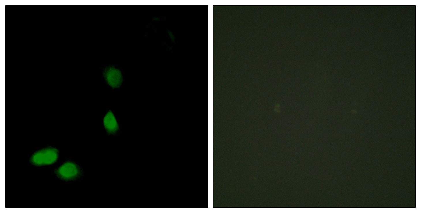 Anti-HMG17 Antibody - Identical to Abcam (ab117637)