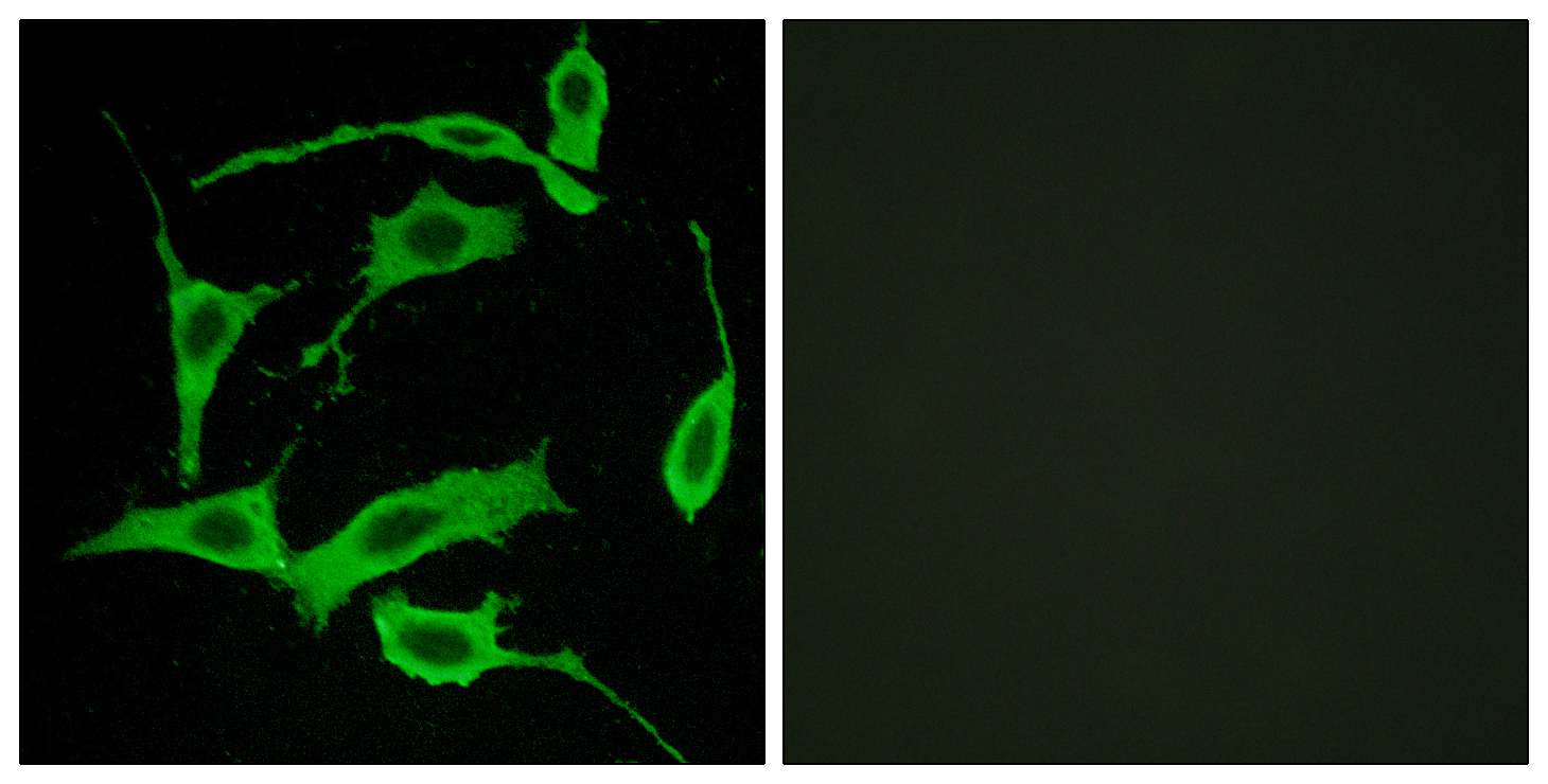 Anti-GPR85 Antibody