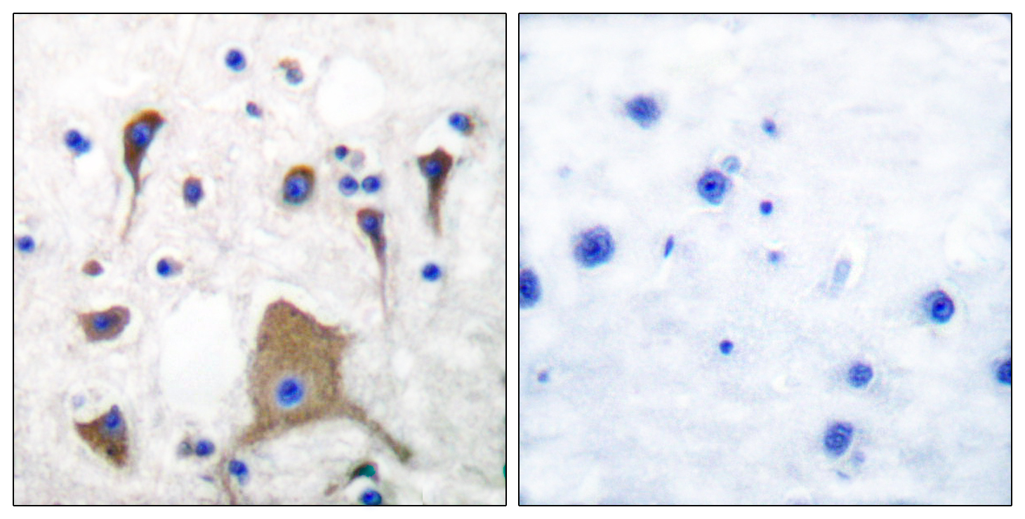 Anti-GluR5 Antibody Anti-GluR5 Antibody