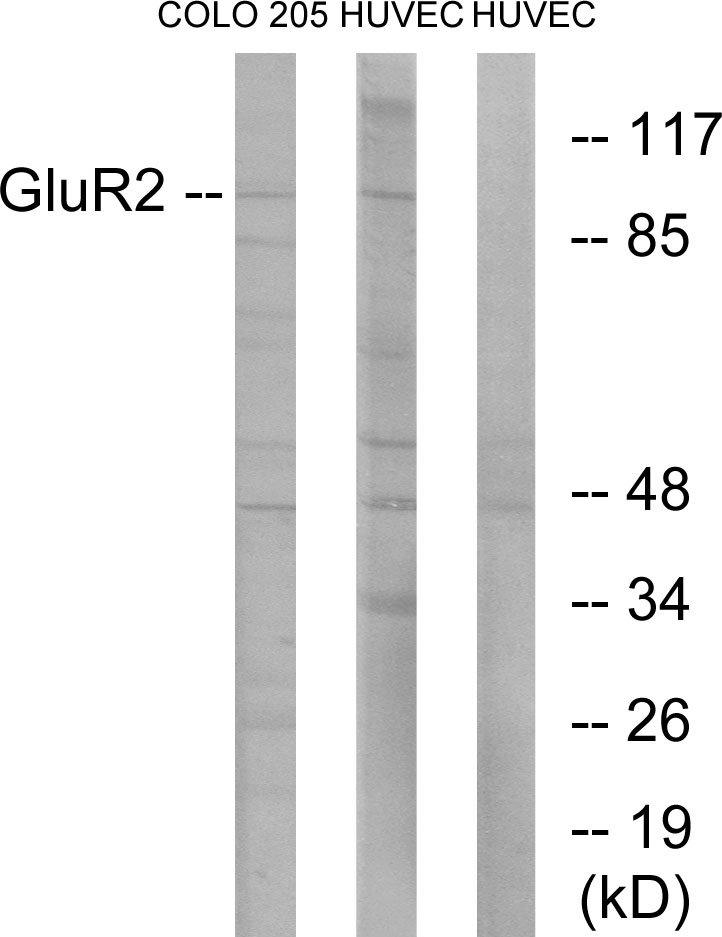 Anti-GluR2 Antibody