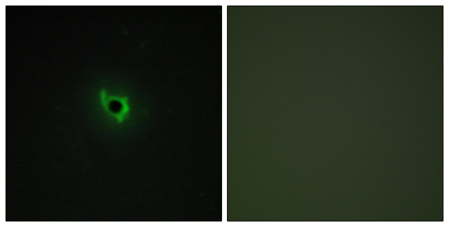 Anti-EPHA6 Antibody - Identical to Abcam (ab113239)