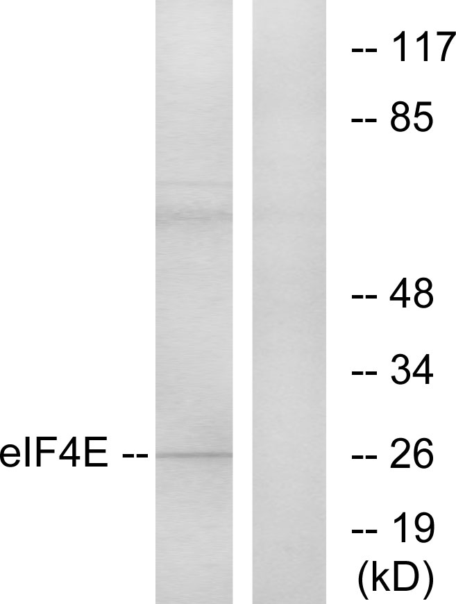 Anti-eIF4E Antibody - Identical to Abcam (ab131480)