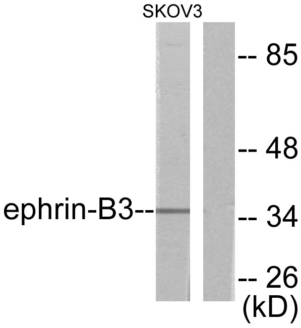 Anti-EFNB3 Antibody - Identical to Abcam (ab53063)