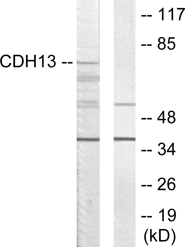 Anti-CDH13 Antibody