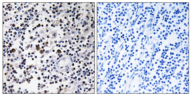 Anti-CD302 Antibody - Identical to Abcam (ab109991)