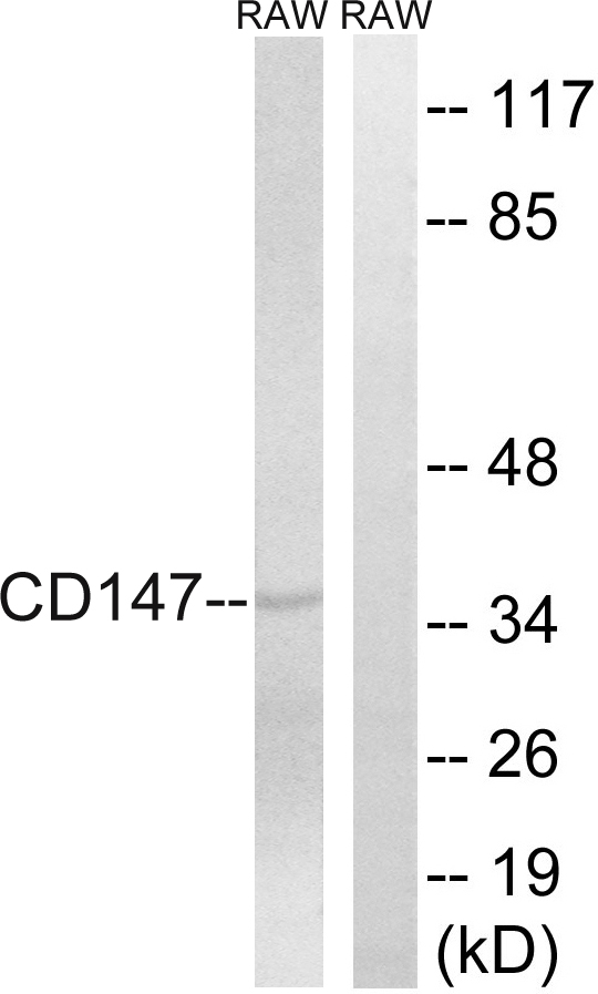 Anti-CD147 Antibody