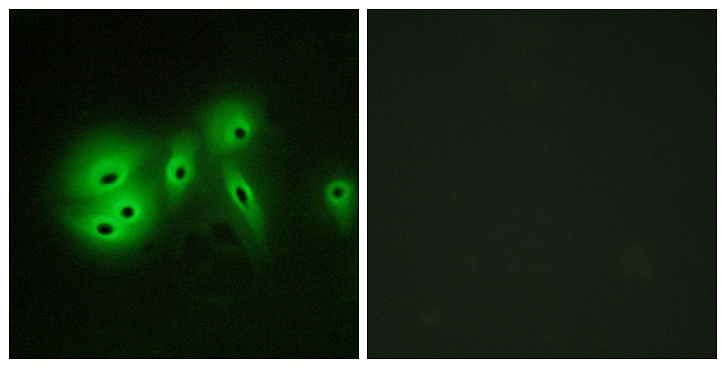 Anti-ADCY8 Antibody - Identical to Abcam (ab196686)