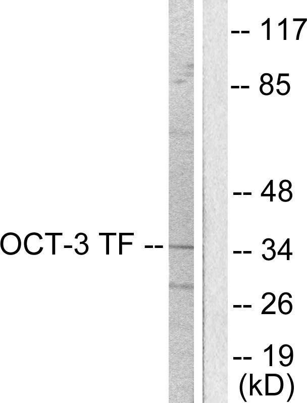 Anti-OCT3 Antibody