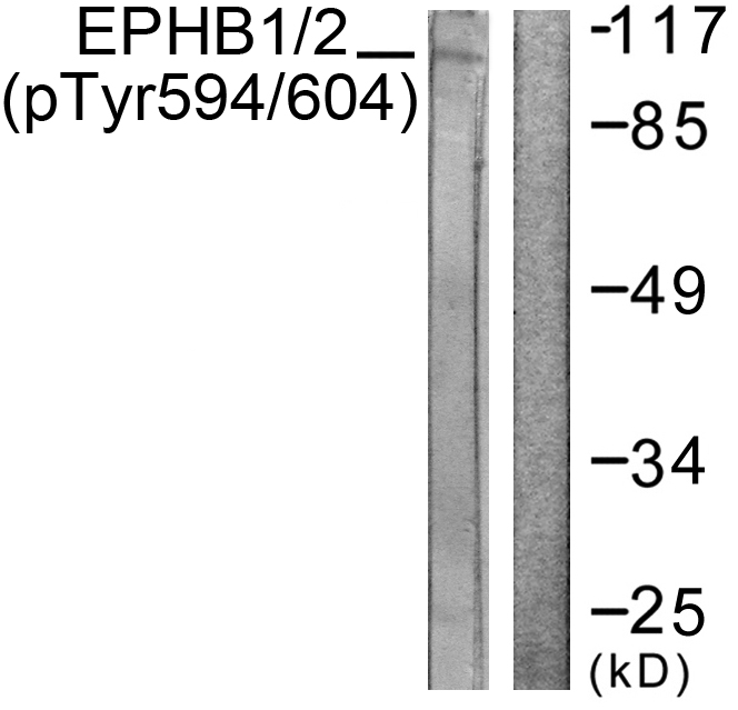 Anti-EPHB1 + EPHB2 (phospho Tyr594 + Tyr604) Antibody