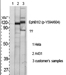 Anti-EPHB1 + EPHB2 (phospho Tyr594 + Tyr604) Antibody Anti-EPHB1 + EPHB2 (phospho Tyr594 + Tyr604) Antibody