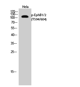 Anti-EPHB1 + EPHB2 (phospho Tyr594 + Tyr604) Antibody Anti-EPHB1 + EPHB2 (phospho Tyr594 + Tyr604) Antibody