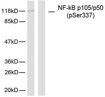 Anti-NF kappa B p105 / p50 (phospho Ser337) Antibody - Identical to Novus (NB100-82074)