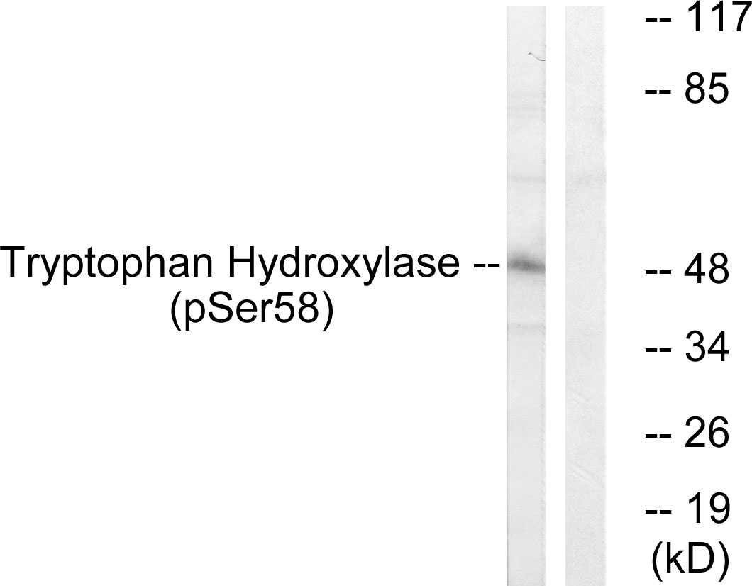 Anti-Tryptophan Hydroxylase (phospho Ser58) Antibody