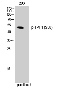 Anti-Tryptophan Hydroxylase (phospho Ser58) Antibody Anti-Tryptophan Hydroxylase (phospho Ser58) Antibody
