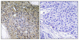 Anti-TGF beta Receptor III (phospho Thr842) Antibody