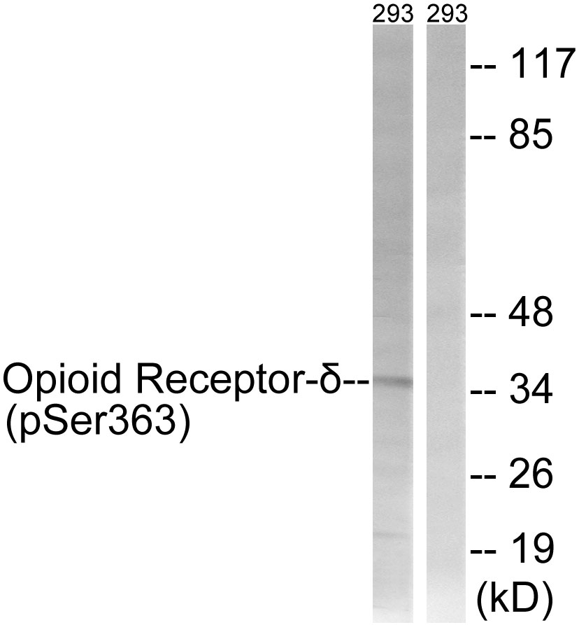 Anti-Opioid Receptor-delta (phospho Ser363) Antibody - Identical to Abcam (ab62152)