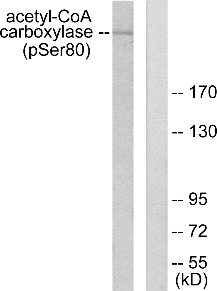 Anti-acetyl CoA Carboxylase (phospho Ser80) Antibody
