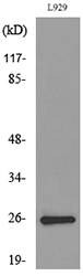Anti-KLRC1 + KLRC2 + KLRC3 Antibody