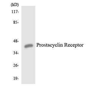 Anti-Prostacyclin Receptor Antibody