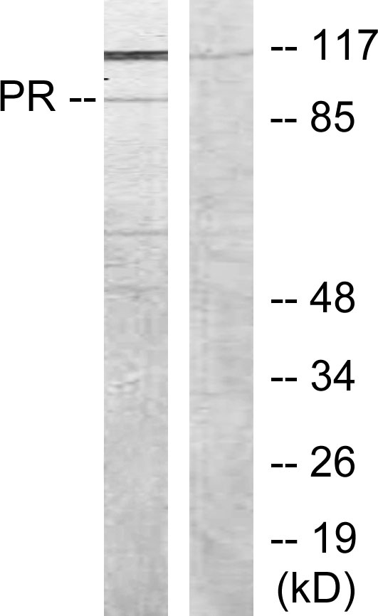 Anti-Progesterone Receptor Antibody