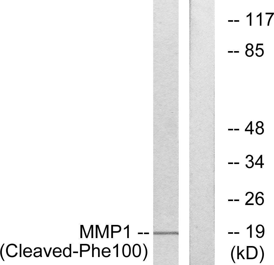 Anti-MMP1 (cleaved Phe100) Antibody