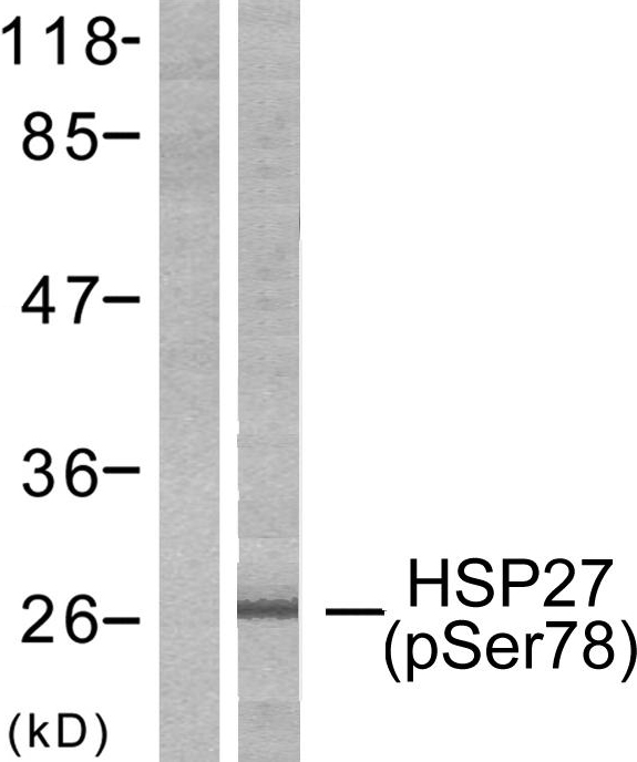 Anti-HSP27 (phospho Ser78) Antibody