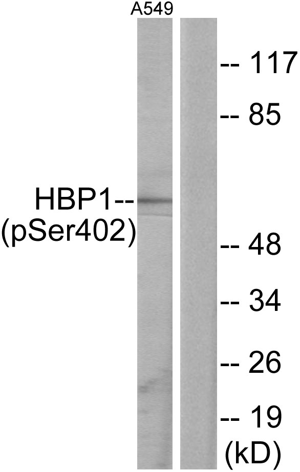Anti-HBP1 (phospho Ser402) Antibody