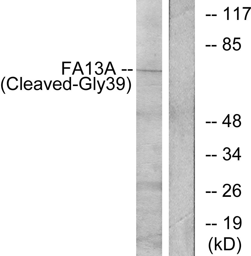 Anti-FA13A (cleaved Gly39) Antibody