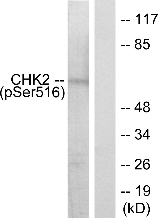 Anti-Chk2 (phospho Ser516) Antibody - Identical to Abcam (ab36724)