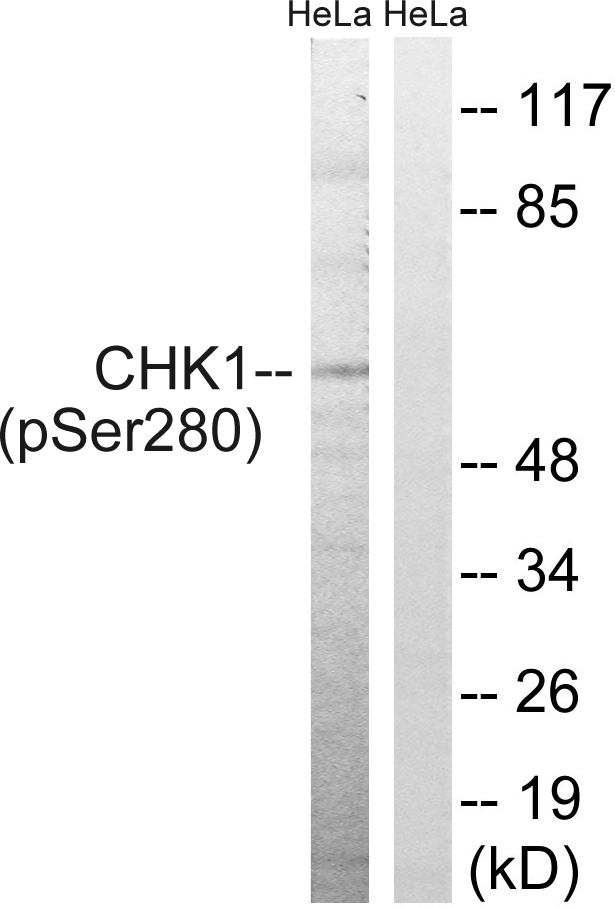 Anti-Chk1 (phospho Ser280) Antibody