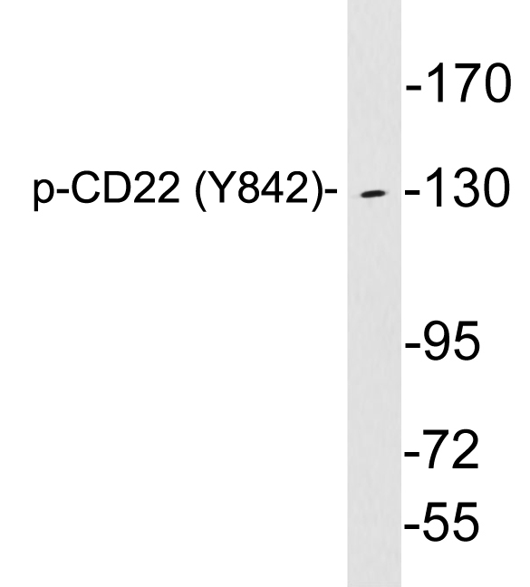 Anti-CD22 (phospho Tyr842) Antibody