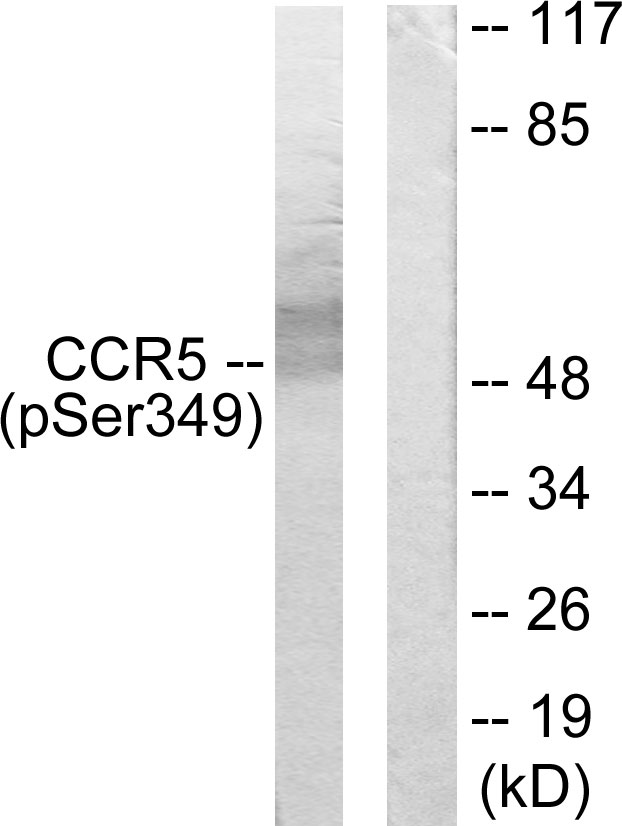 Anti-CCR5 (phospho Ser349) Antibody