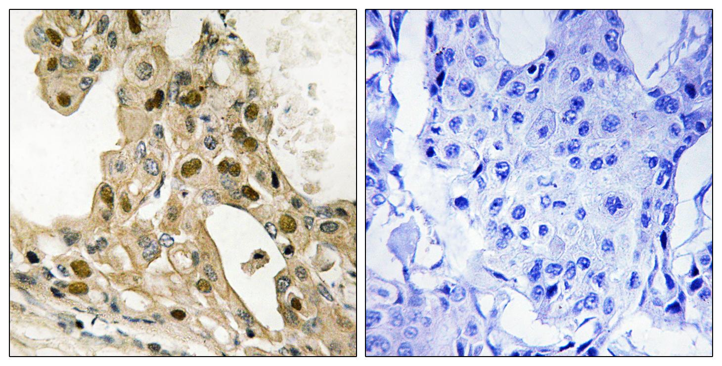 Anti-p53 (phospho Thr387) Antibody