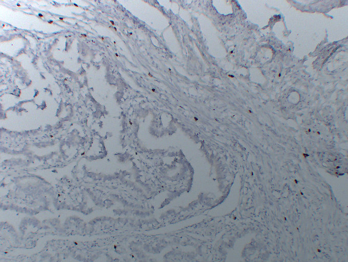 Anti-Mast Cell Tryptase Antibody [ABT-MCT]