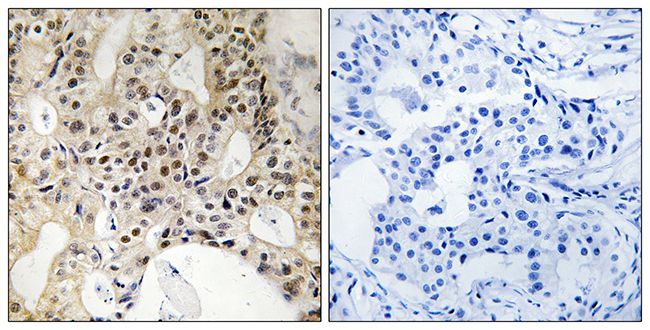 Anti-LATS1 + LATS2 Antibody