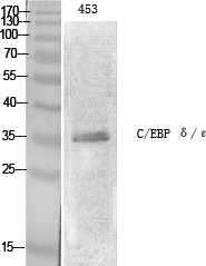 Anti-CEBP epsilon Antibody Anti-CEBP epsilon Antibody